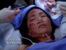 Grey's Anatomy photo 5 (episode s03e09)