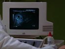 Nip/Tuck photo 8 (episode s02e08)