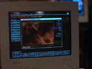 Stargate SG-1 photo 7 (episode s01e09)